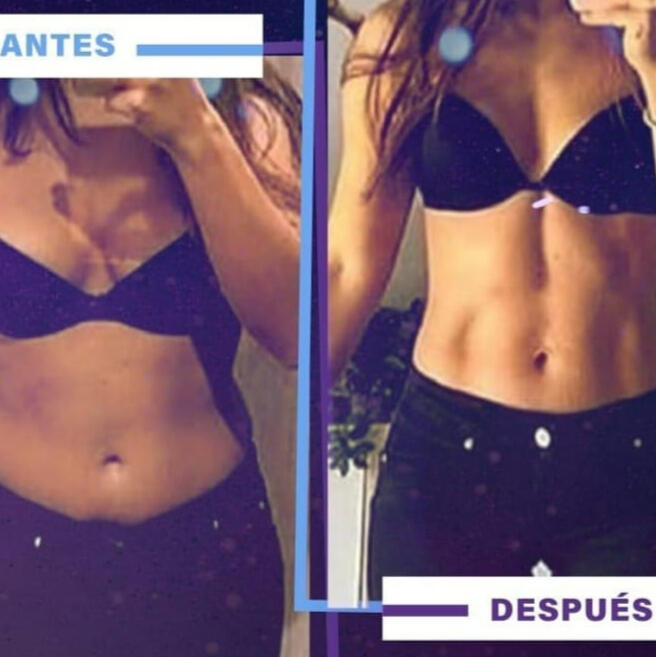 ANTES DESPUES